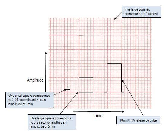 Electrocardiograph (ECG) - ALS Now